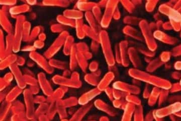 legionella